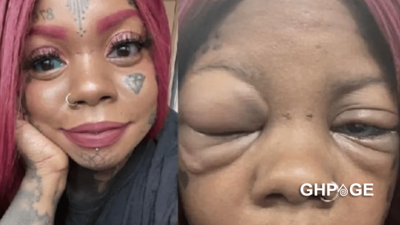 Mother Going Blind After Tattooing Her Eyeballs Blue And Purple To Copy An Influencer GhPage